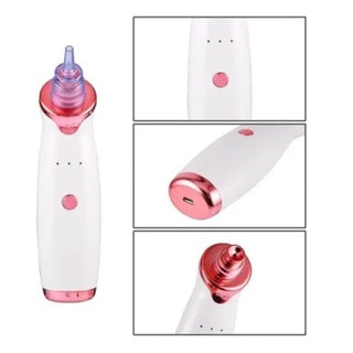 Electric Blackhead Remover – Vacuum Suction Pore Cleaner for Deep Facial Cleansing