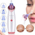 Electric Blackhead Remover – Vacuum Suction Pore Cleaner for Deep Facial Cleansing