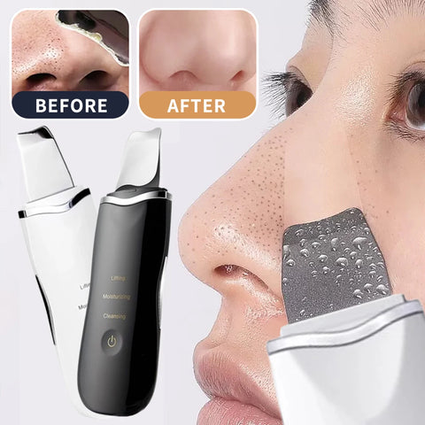 4-in-1 Ultrasonic Facial Cleansing Spatula