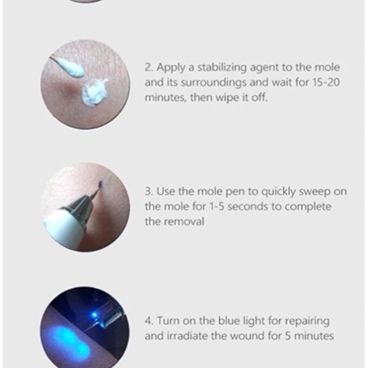 Surgical 100Pcs Sterile Mini Mole Removal Pen Needles for Spot Freckle Plasma Point Machine Tattoo Supplies