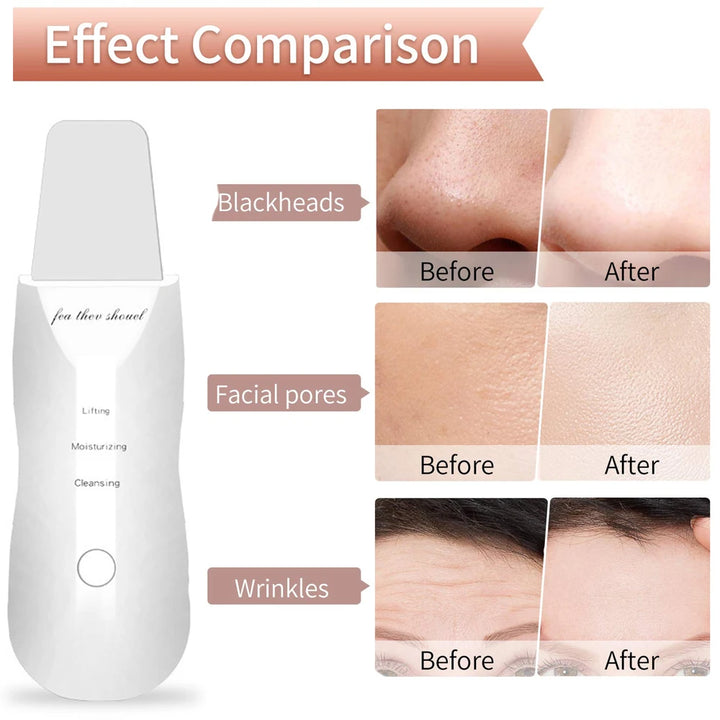 4-in-1 Ultrasonic Facial Cleansing Spatula