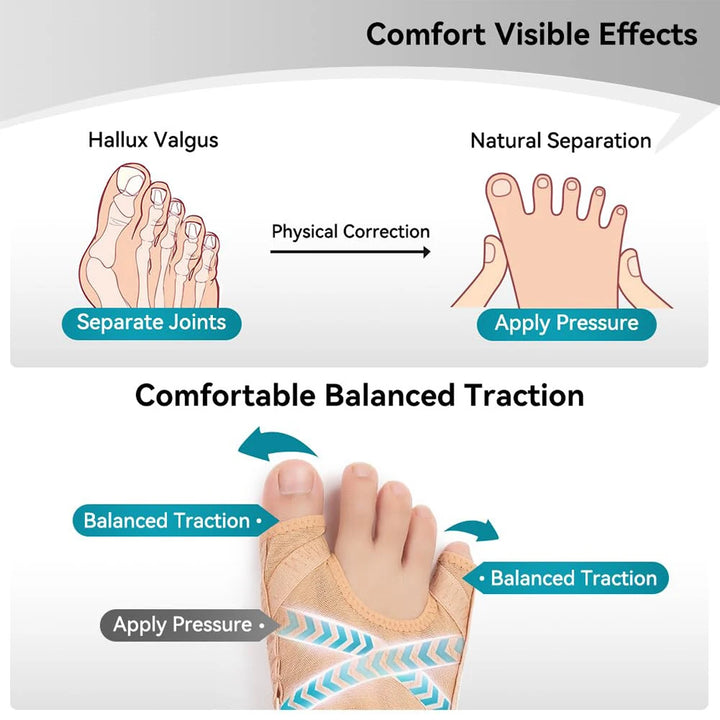 Fabric Gel Bunion Corrector with Toe Separator – MERALL