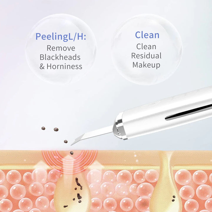 4-in-1 Ultrasonic Facial Cleansing Spatula