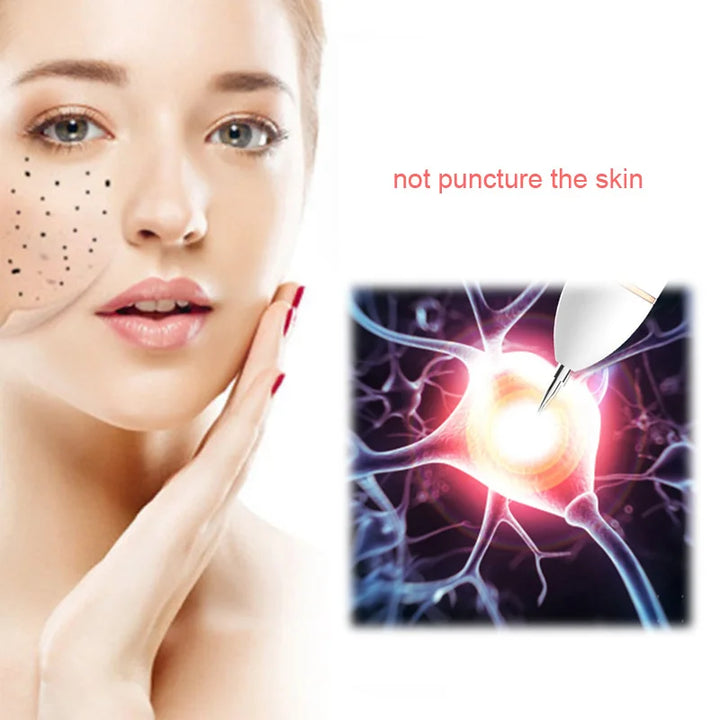 Surgical 100Pcs Sterile Mini Mole Removal Pen Needles for Spot Freckle Plasma Point Machine Tattoo Supplies