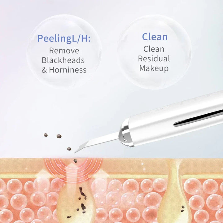 4-in-1 Ultrasonic Facial Cleansing Spatula