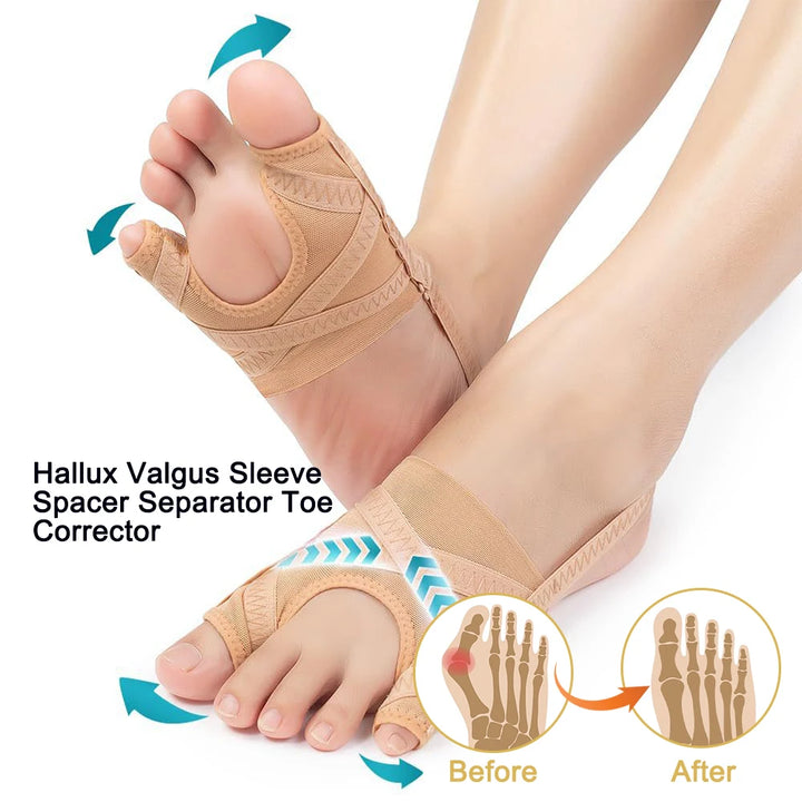 Fabric Gel Bunion Corrector with Toe Separator – MERALL