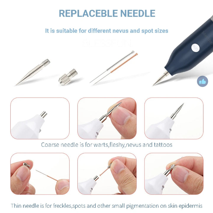 Surgical 100Pcs Sterile Mini Mole Removal Pen Needles for Spot Freckle Plasma Point Machine Tattoo Supplies